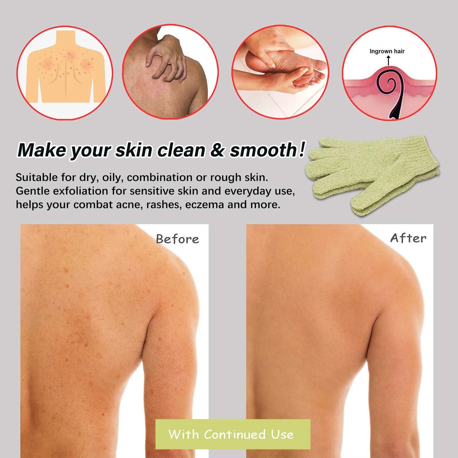 MIG4U Shower Exfoliating Scrub Gloves Medium to Heavy Bathing Gloves Body Wash Dead Skin Removal Deep Cleansing Sponge Loofah for Women and Men(1 Pair, Chartreuse)
